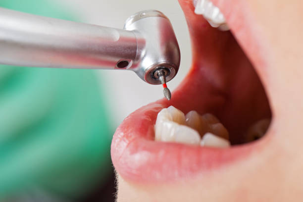 Best After-Hours Emergency Dentist in Georgetown, IL